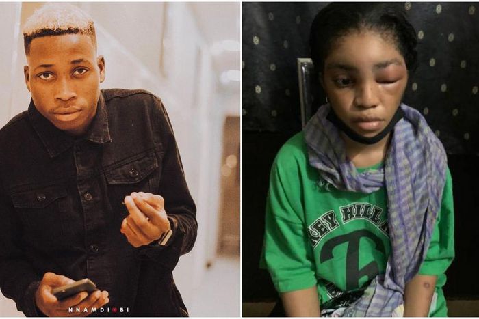 Lil Frosh is being accused of beating his girlfriend, Camille to the pulp [Instagram/LhilFrosh] [KemiFilani]