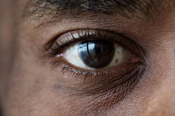 Take care of your eyes [dukehealth]