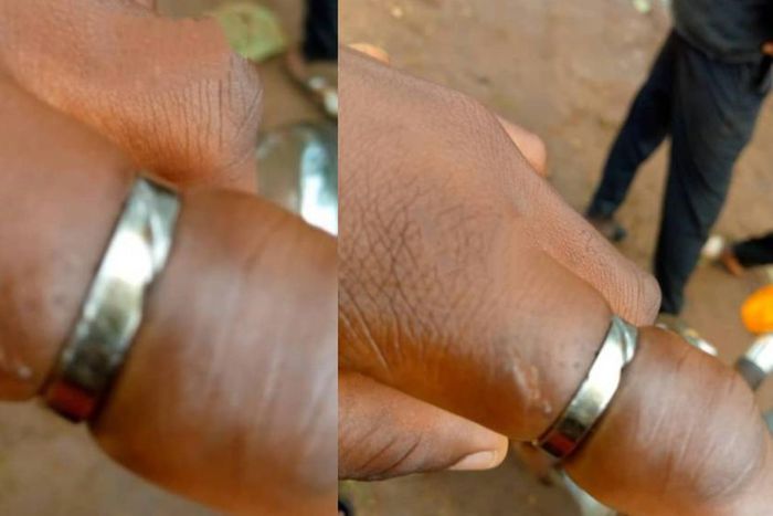 Evelyn Detordzi's finger