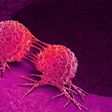 Cancer is caused by cell mutation [Everydayhealth]
