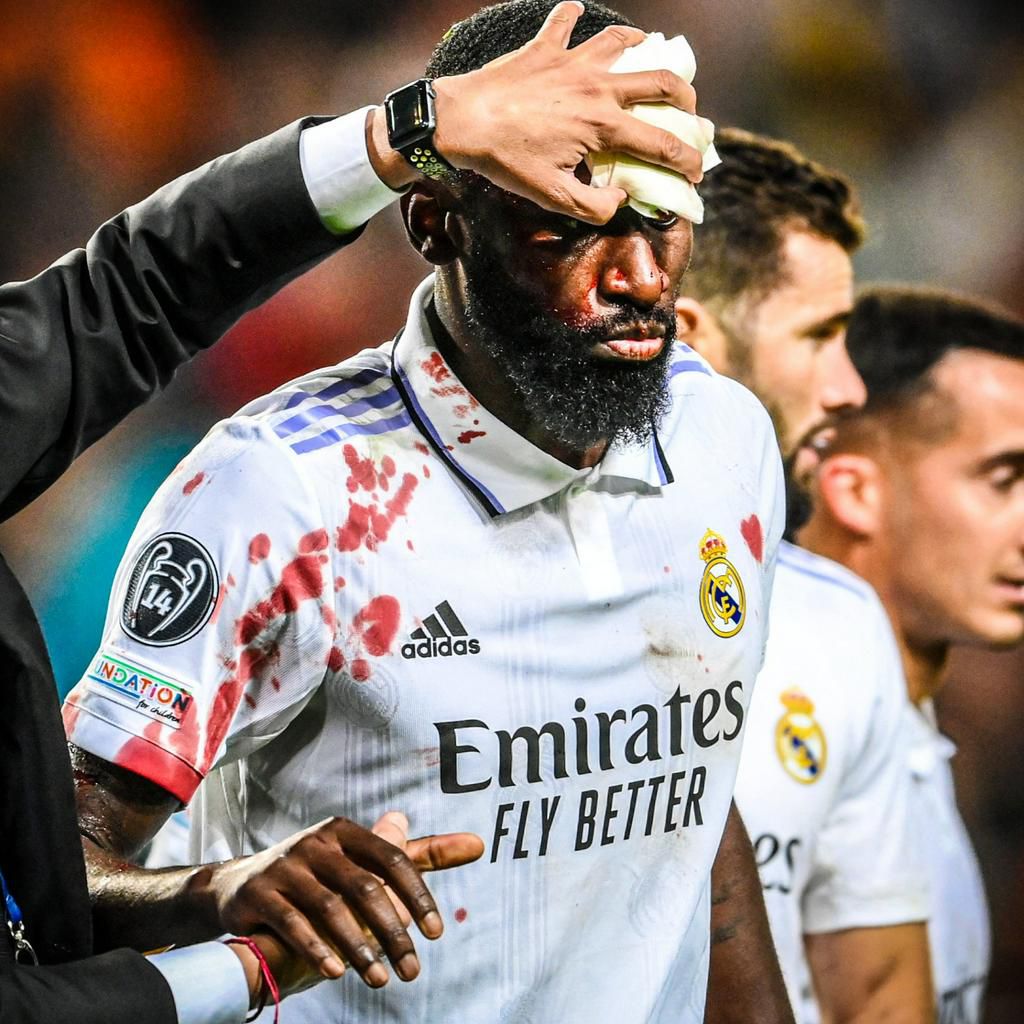 Rudiger sheds blood to rescue a point for Real Madrid against Shakhtar Donetsk