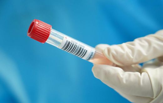 A nurse holds the tube containing the photographer's throat and nose swab sample for a Covid-19 test at a hospital on the 2nd day of his 14-day quarantine during the second wave of the coronavirus pandemic on October 29, 2020 in Stahnsdorf, Germany.