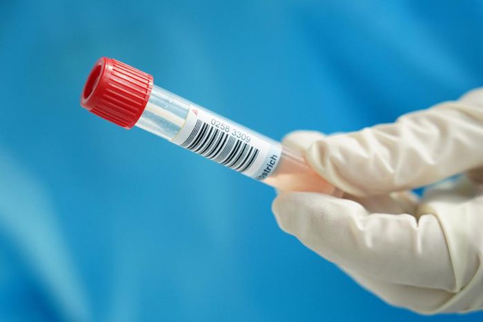 A nurse holds the tube containing the photographer's throat and nose swab sample for a Covid-19 test at a hospital on the 2nd day of his 14-day quarantine during the second wave of the coronavirus pandemic on October 29, 2020 in Stahnsdorf, Germany.