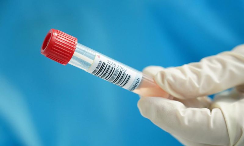 A nurse holds the tube containing the photographer's throat and nose swab sample for a Covid-19 test at a hospital on the 2nd day of his 14-day quarantine during the second wave of the coronavirus pandemic on October 29, 2020 in Stahnsdorf, Germany.