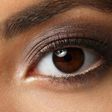 Eye Colour: Change Here are the possible causes of this condition