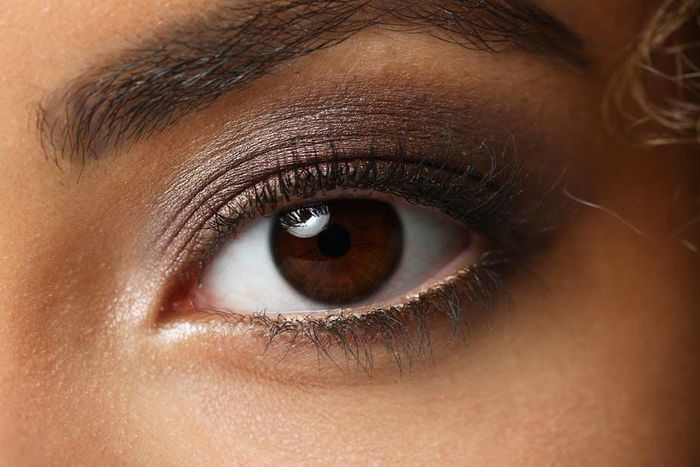 Eye Colour: Change Here are the possible causes of this condition