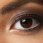 Eye Colour: Change Here are the possible causes of this condition