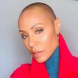 Jada is believed to have alopecia [Instagram/Jada]