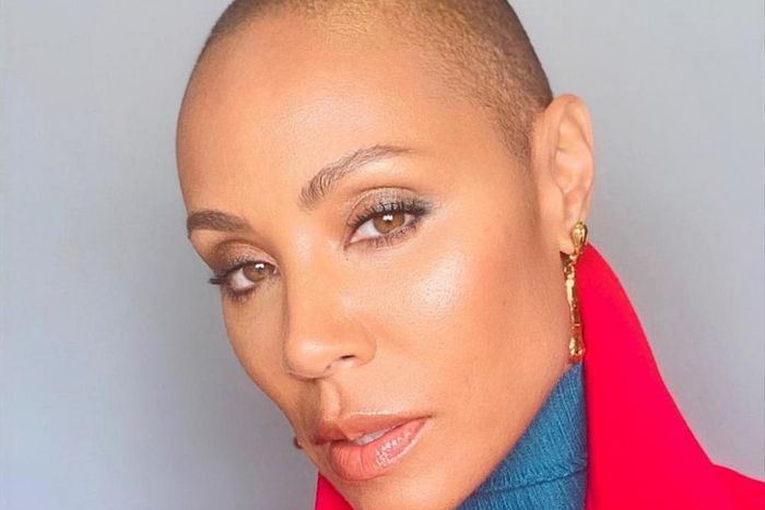 Jada is believed to have alopecia [Instagram/Jada]