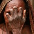 Older women of the Dani tribe with snipped fingers. [Facebook/Henry Kally Jme]