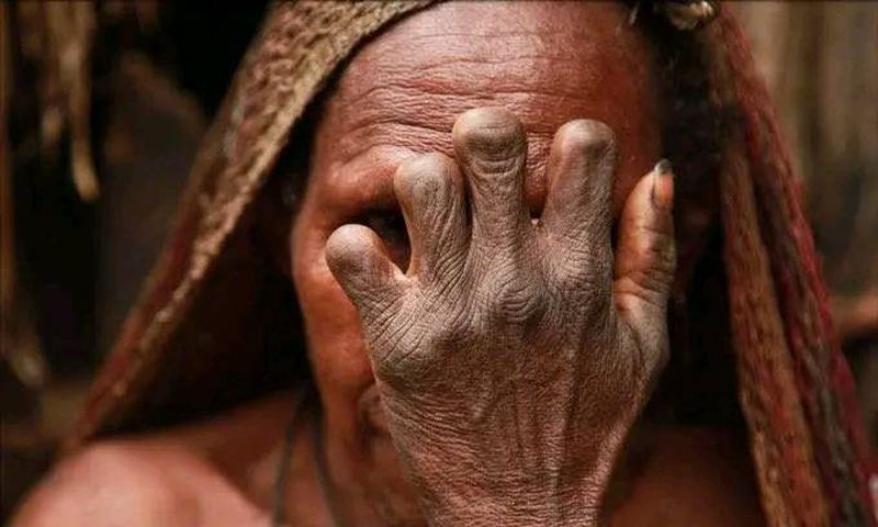 Older women of the Dani tribe with snipped fingers. [Facebook/Henry Kally Jme]