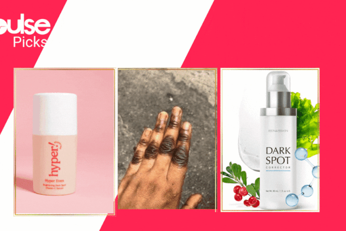 Best creams for dark knuckles