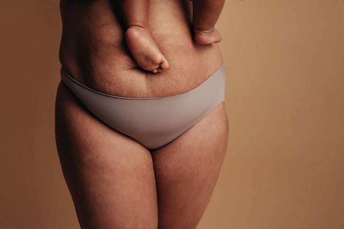 Belly wrapping can be a valuable part of your postpartum recovery [Parents]