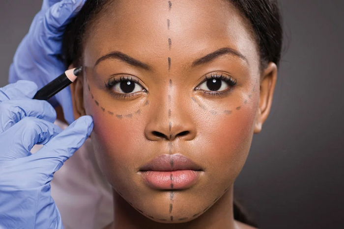 Here's what to know before you go under the knife {drsnijman]