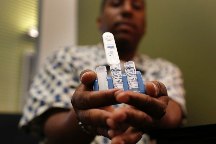 hiv aids antibody test