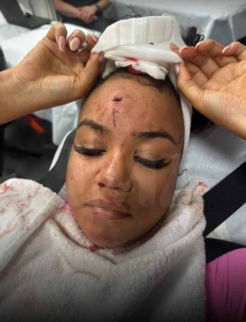 The victim's injury [TMZ]