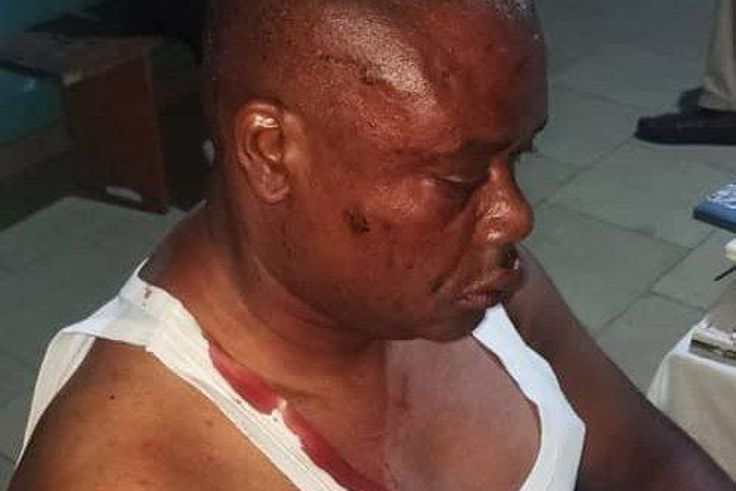 One person injured as PDP, APC supporters clash over election materials. [Punch]