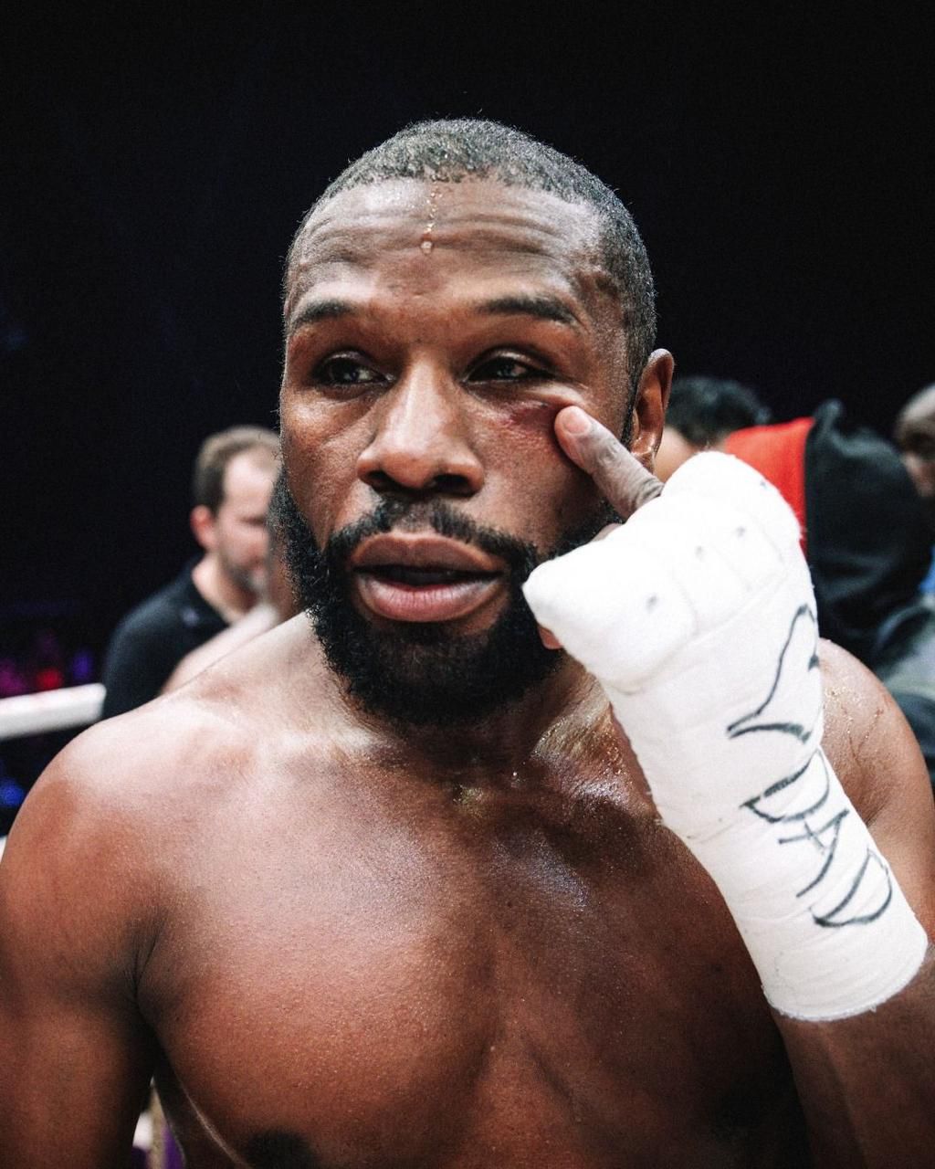 Deji fought back and even gave Mayweather a black eye in the middle rounds.