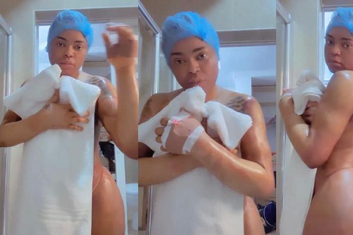 Bob Risky goes for b*tt enhancement again, shares 'wounded and healing' new body