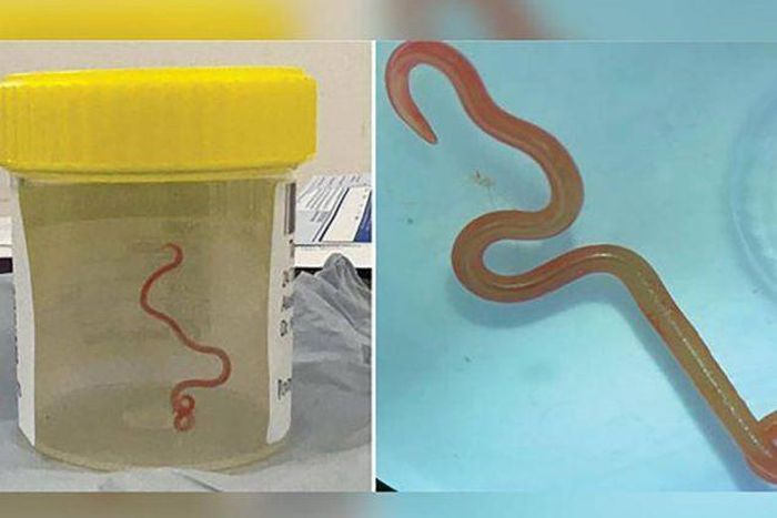 Eight-cm Ophidascaris robertsi roundworm, usually found in pythons (Credit: BOL News)