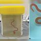 Eight-cm Ophidascaris robertsi roundworm, usually found in pythons (Credit: BOL News)