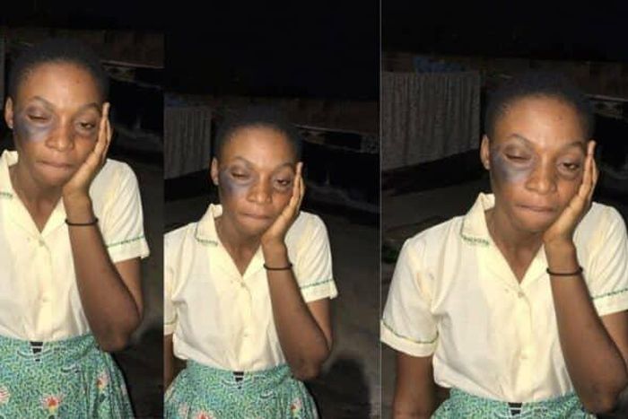Female student goes partially blind after slap by Nkwatia Presby SHS headmaster
