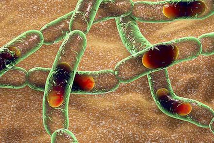 First case of anthrax has been confirmed in Nigeria. [CDC]