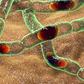 First case of anthrax has been confirmed in Nigeria. [CDC]