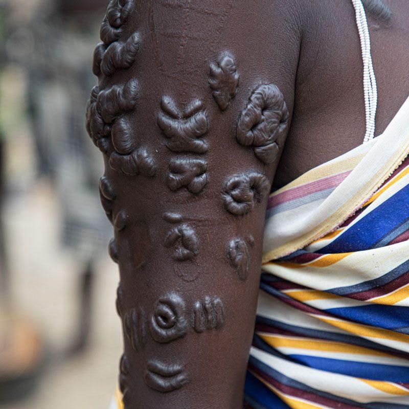 The scars are intricate [lastplaces]