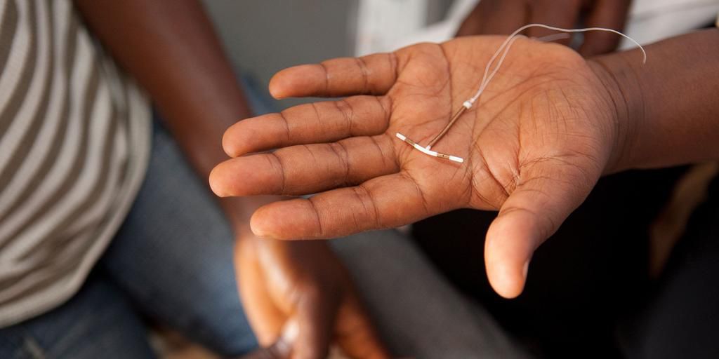 IUD have many adverse effects [todaynews]