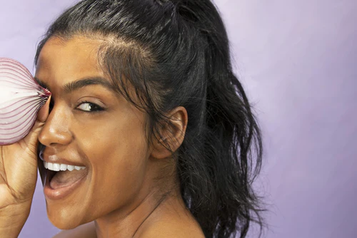 Use onion juice if you have bald patches in your hair [wowskincare]