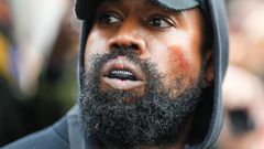 Ye, who is also known as Kanye West, is seen wearing a Balenciaga boxing mouthguard, outside Givenchy, during Paris Fashion Week.Edward Berthelot/GC Images