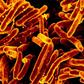 Tuberculosis bacteriaCDC