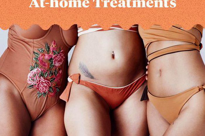 World's most beautiful vagina contest [Pinterest]