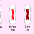 Menstrual bleeding colour [invitra]