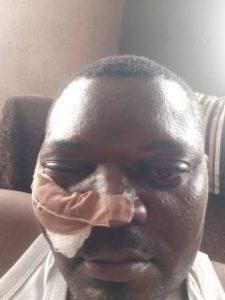 A picture of LASTMA officer injured