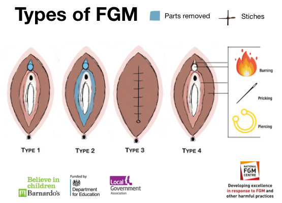 Graphic representation of FGM [NationalFGMCentre]