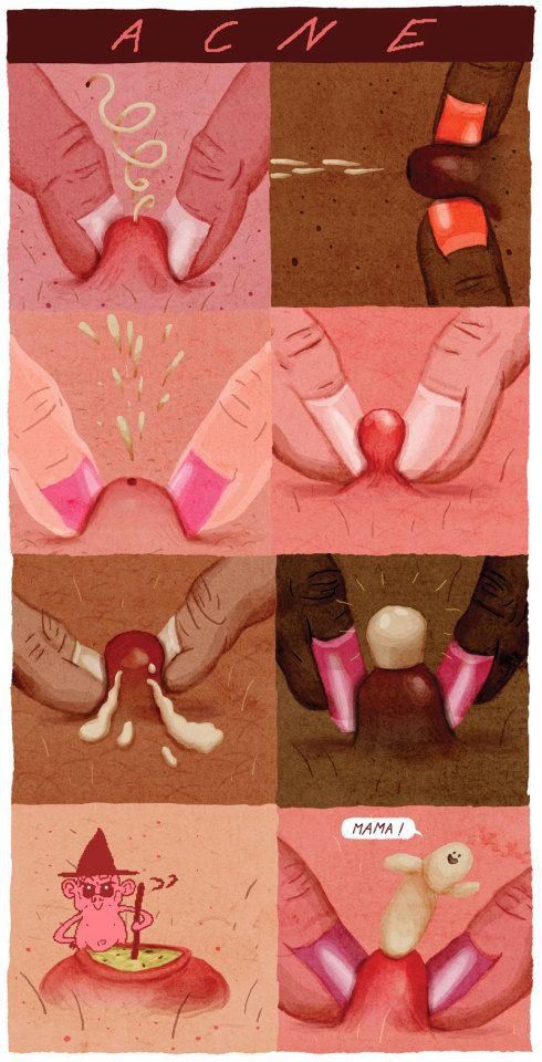 Avoid popping your pimples [Pinterest]