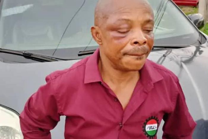 NLC President, Joe Ajaero after alleged mob attack in Imo State during Wednesday, protest. [Vanguard]