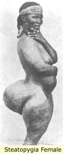 Steatopygia is a condition that was common among the Khoisan people [SanFranBay]