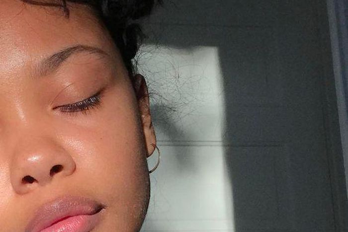 Get a clearer skin with these natural solutions [Pinterest]