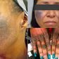 Using bleaching creams can permanently damageyour skin [DailyTrust]