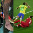 Brazil boss Tite confident Neymar will play despite swollen ankle