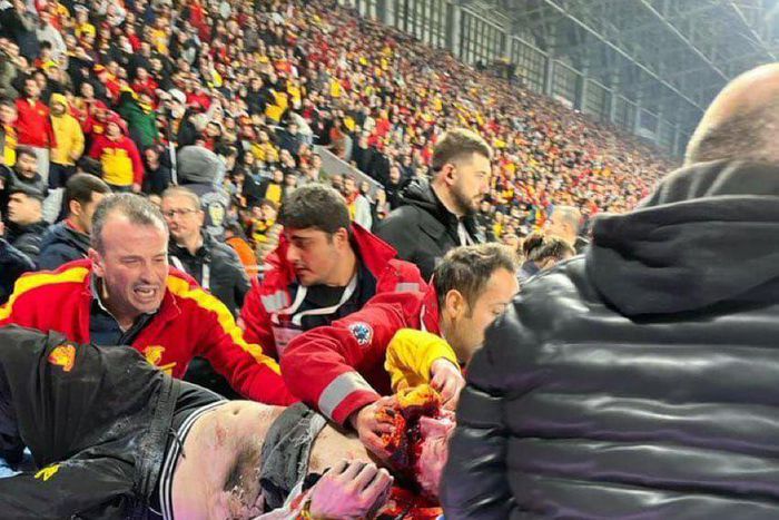 Ballistics launched in multiple cases of fan violence in Turkish Super Lig