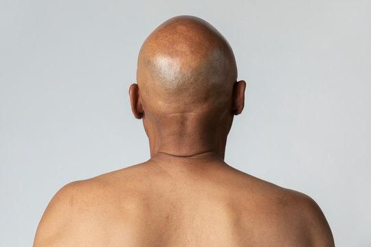 Man with bald head