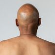 Man with bald head