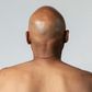 Man with bald head