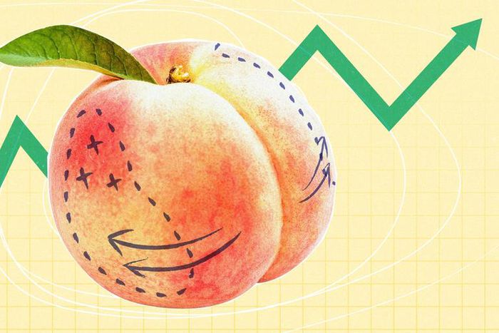 Plastic surgeons said high demand for Brazilian butt lifts (or "BBLs") has resulted in a record number of cosmetic surgery appointments.