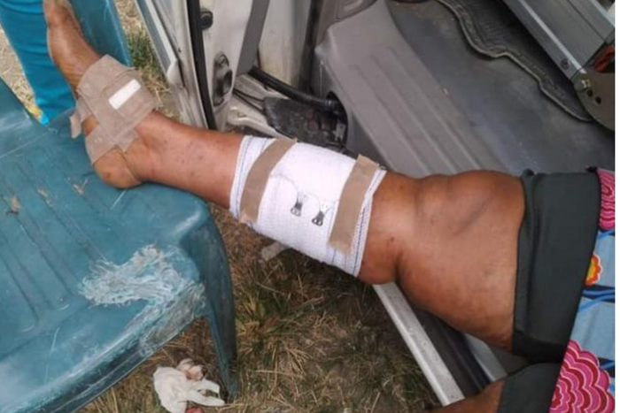 Explosion rocks APC rally in Rivers State (ThePunch)