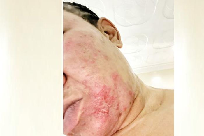 Abuja judge, therapist trade blame after cosmetic surgery goes wrong